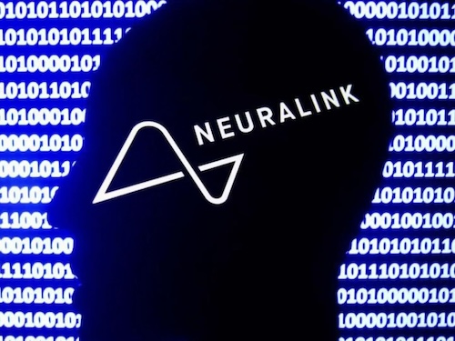 I primi risultati di Neuralink su un umano