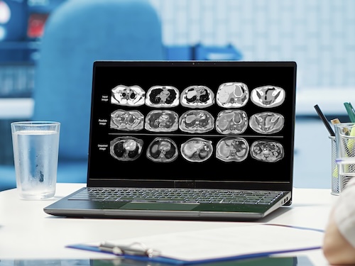 CNAO: l’intelligenza artificiale può supportare l’adroterapia oncologica?