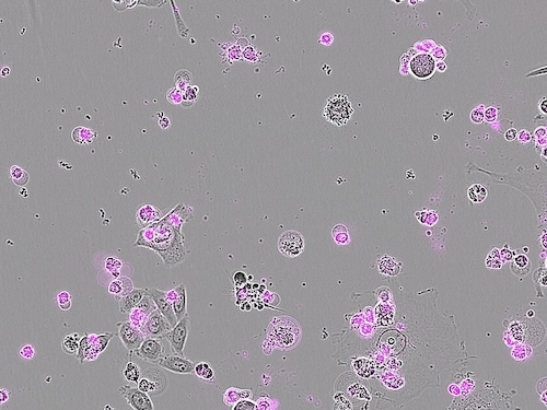 Una nuova tecnica CRISPR contro i tumori